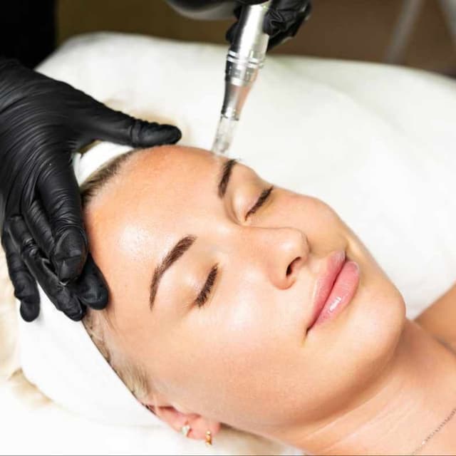 Microneedling | HA x 3 at GEM Beauty Bar in Cottonwood, AZ